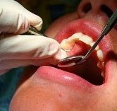 Photo of Richard U Mascera Jr DDS in Montclair City, New Jersey, United States - 4 Picture of Point of interest, Establishment, Health, Doctor, Dentist