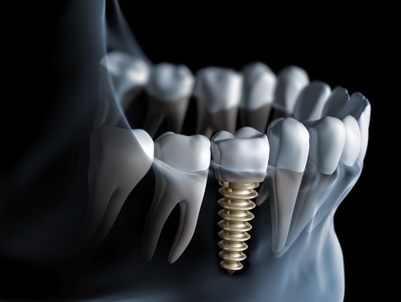 Photo of Glen Oaks Implants in Glen Oaks City, New York, United States - 3 Picture of Point of interest, Establishment, Health, Dentist