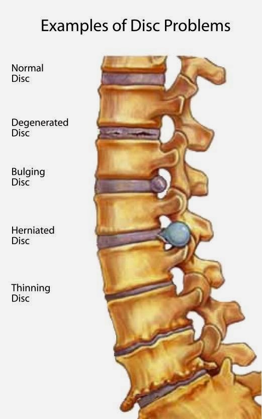 Photo of Laser Spine & Pain Specialists: Dr. Randolph Kahn, DO in Union City, New Jersey, United States - 1 Picture of Point of interest, Establishment, Health, Doctor