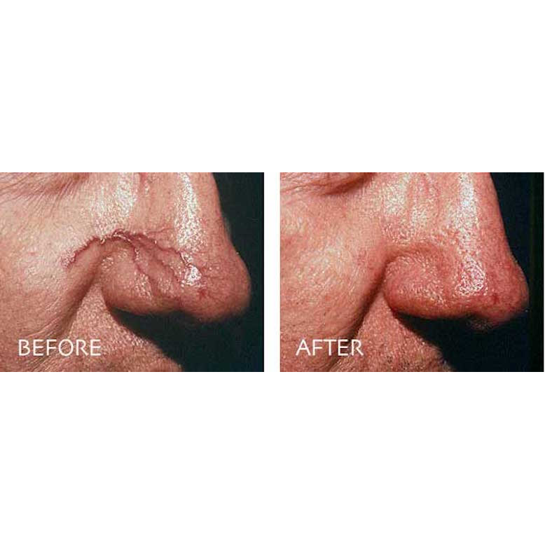 Photo of Juvederm in New York City, New York, United States - 3 Picture of Point of interest, Establishment, Health, Doctor