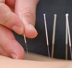 Photo of Restore Qi Acupuncture, LLC in Highlands City, New Jersey, United States - 4 Picture of Point of interest, Establishment, Health, Doctor