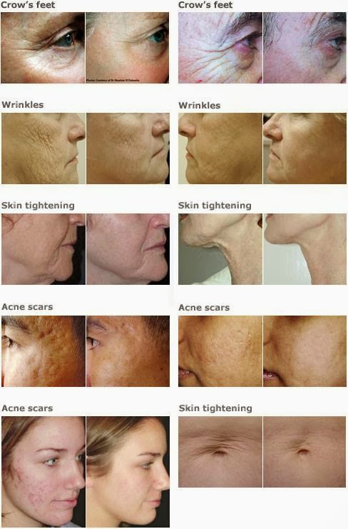 Photo of Enhance Laser skin care in Edgewater City, New Jersey, United States - 5 Picture of Point of interest, Establishment, Health