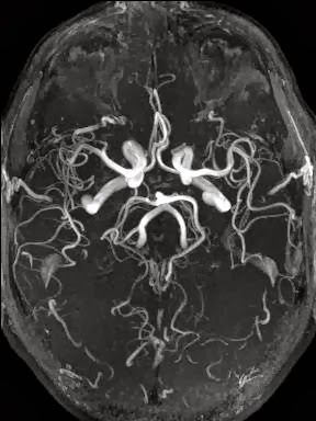 Photo of Alpha 3T MRI & Diagnostic Imaging Center in New York City, New York, United States - 5 Picture of Point of interest, Establishment, Health, Doctor