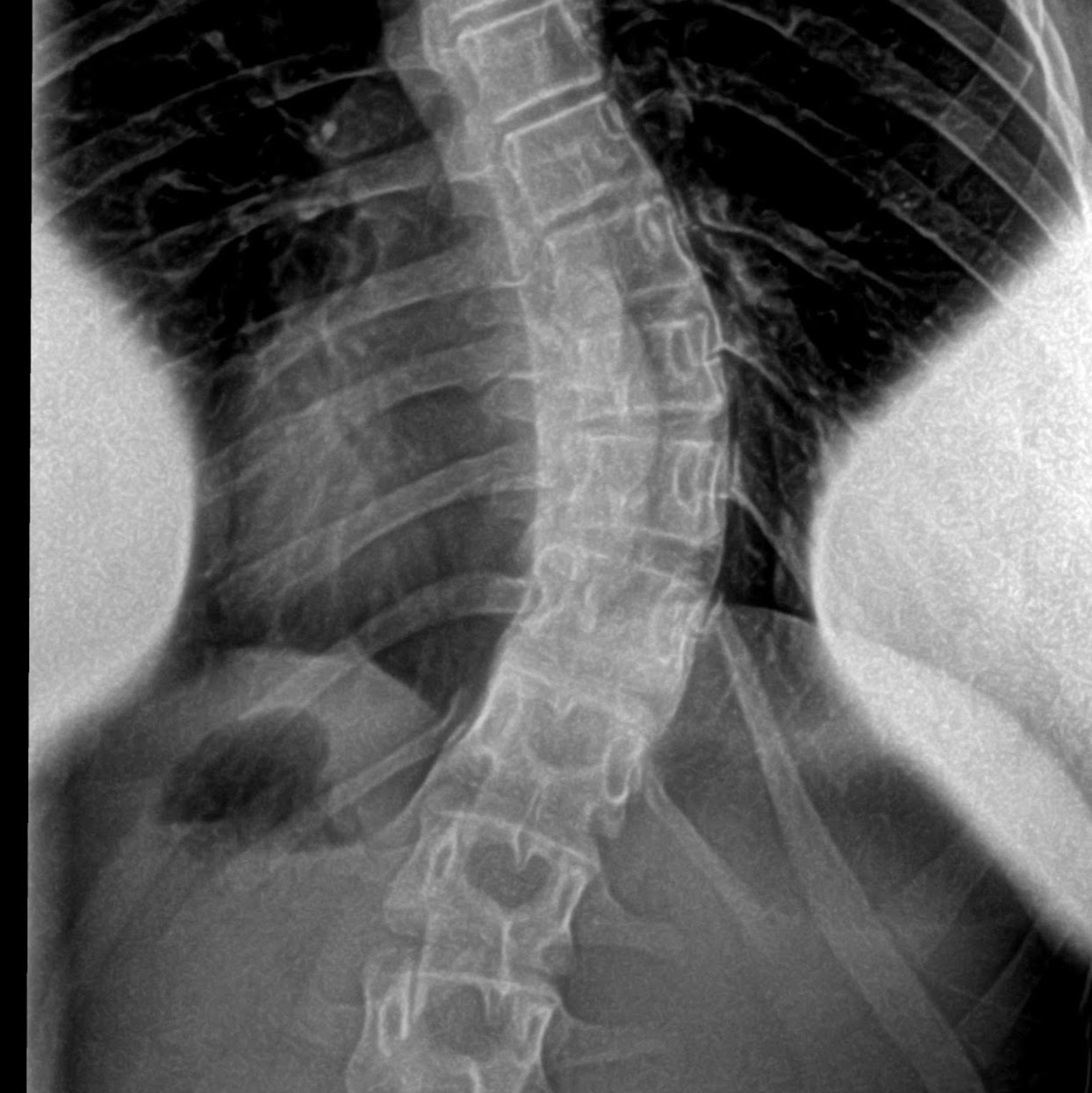Photo of Scoliosis Systems in New York City, New York, United States - 1 Picture of Point of interest, Establishment, Health