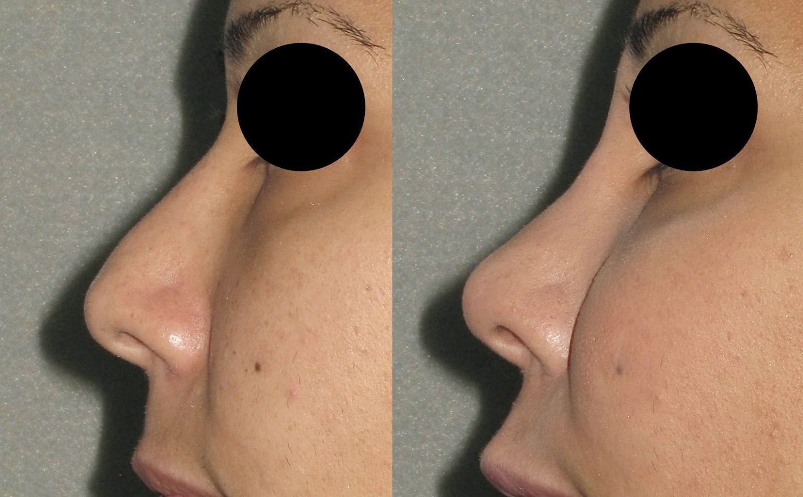 Photo of Cosmetic Laser MD in Livingston City, New Jersey, United States - 7 Picture of Point of interest, Establishment, Health, Doctor, Spa, Beauty salon, Hair care