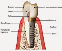 Photo of Sola Dental Spa in Staten Island City, New York, United States - 9 Picture of Point of interest, Establishment, Health, Doctor, Dentist