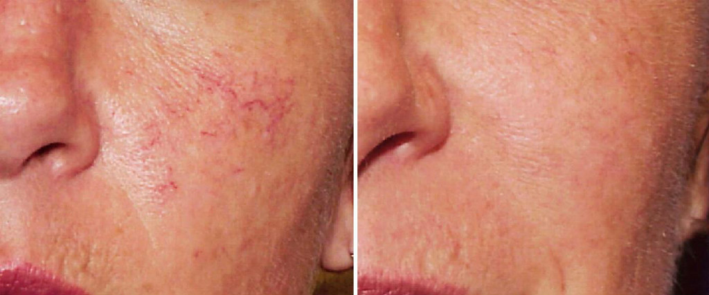 Photo of Juvederm in New York City, New York, United States - 2 Picture of Point of interest, Establishment, Health, Doctor