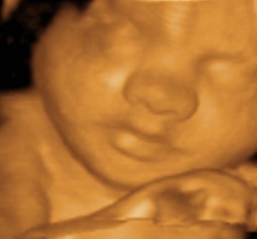 Photo of 1st Glimpse Inc. 3D/4D Ultrasound in Kings County City, New York, United States - 4 Picture of Point of interest, Establishment, Health, Doctor