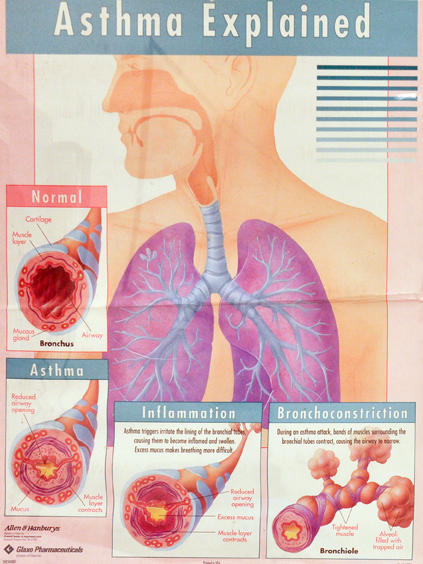 Photo of Allergy and Immunology on Madison in New York City, New York, United States - 5 Picture of Point of interest, Establishment, Health, Doctor