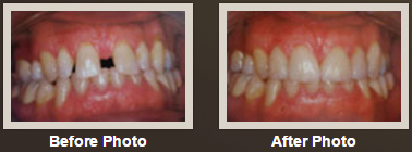 Photo of Essex Dental Associates in South Orange City, New Jersey, United States - 3 Picture of Point of interest, Establishment, Health, Dentist