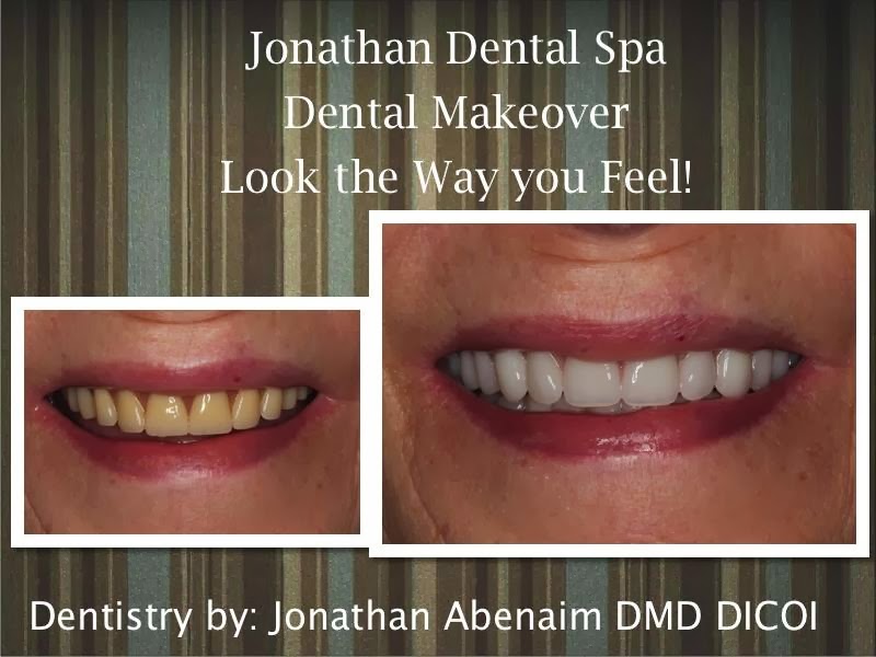 Photo of Jonathan Dental Spa Dental Implant Center Jonathan Abenaim DMD in Hawthorne City, New Jersey, United States - 2 Picture of Point of interest, Establishment, Health, Dentist