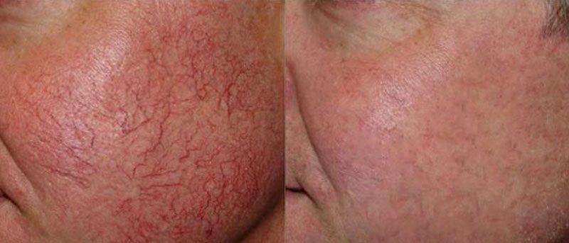 Photo of Rosacea NYC in New York City, New York, United States - 5 Picture of Point of interest, Establishment, Health, Doctor