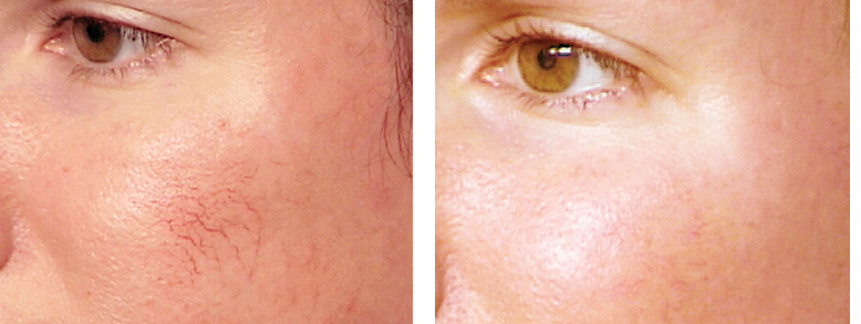 Photo of Juvederm in New York City, New York, United States - 5 Picture of Point of interest, Establishment, Health, Doctor