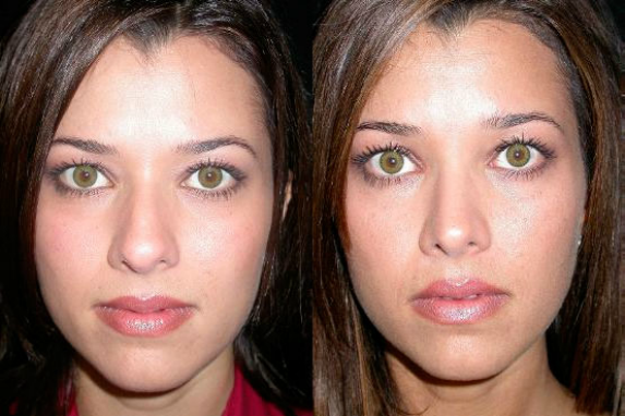 Photo of Park Avenue Rhinoplasty in New York City, New York, United States - 10 Picture of Point of interest, Establishment, Health, Doctor