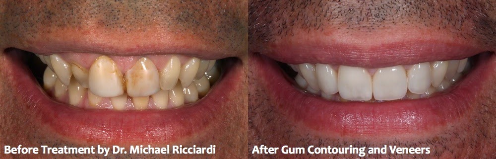 Photo of Dr. Michael T. Ricciardi, DDS in Staten Island City, New York, United States - 9 Picture of Point of interest, Establishment, Health, Dentist