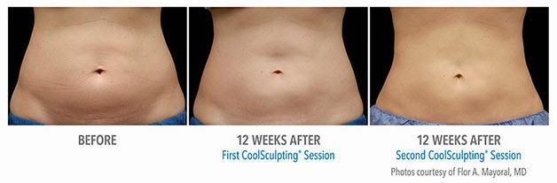 Photo of CoolSculpting Spa of Long Island in Great Neck City, New York, United States - 7 Picture of Point of interest, Establishment, Health, Hospital, Doctor