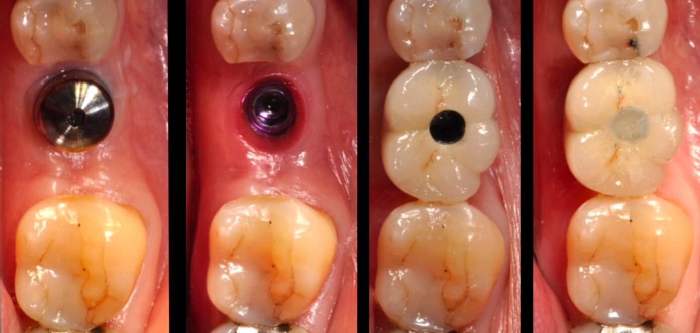 Photo of Charlie Chen DDS / 诚和植牙牙科中心 / 3D Dental Implant Center in Kings County City, New York, United States - 8 Picture of Point of interest, Establishment, Health, Doctor, Dentist