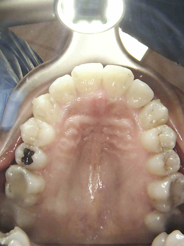 Photo of Smile Dental of New Rochelle in New Rochelle City, New York, United States - 7 Picture of Point of interest, Establishment, Health, Dentist