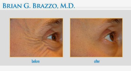 Photo of NYC Eyelid and Ophthalmic Plastic Surgery in New York City, New York, United States - 2 Picture of Point of interest, Establishment, Health, Doctor