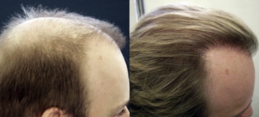 USNY Trichology Institute Hair Loss Specialty Group in New York City, New York, United States - #3 Photo of Point of interest, Establishment, Health, Hair care