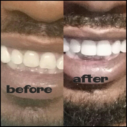 Cyrus Dental: Haghighi Babak DDS in Newark City, New Jersey, United States - #2 Photo of Point of interest, Establishment, Health, Dentist