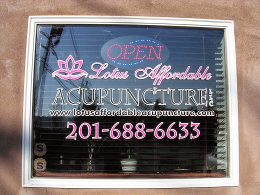 Lotus Affordable Acupuncture, LLC. in Lodi City, New Jersey, United States - #2 Photo of Point of interest, Establishment, Health