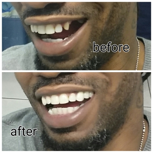Cyrus Dental: Haghighi Babak DDS in Newark City, New Jersey, United States - #1 Photo of Point of interest, Establishment, Health, Dentist