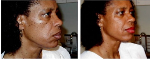 Dermatosis Papulosa Nigra NYC in New York City, New York, United States - #4 Photo of Point of interest, Establishment, Health, Doctor