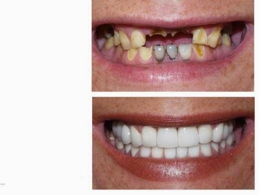 Photo by Brooklyn Cosmetic and Implant Dentistry, PC for Brooklyn Cosmetic and Implant Dentistry, PC