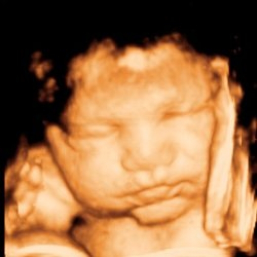 Photo by Clear Image 4D Ultrasound - Staten Island for Clear Image 4D Ultrasound - Staten Island