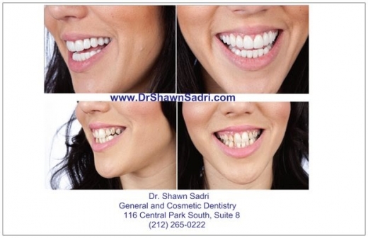Dr. Shawn Sadri DMD in New York City, New York, United States - #3 Photo of Point of interest, Establishment, Health, Dentist