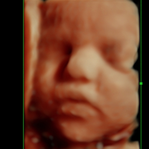 Photo by 3D Maternity Imaging for 3D Maternity Imaging