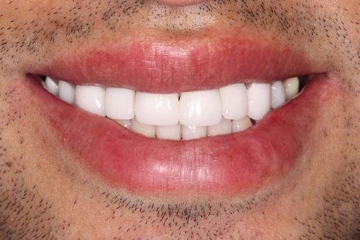 Jeffrey G. Apfel, DDS in Queens City, New York, United States - #3 Photo of Point of interest, Establishment, Health, Dentist