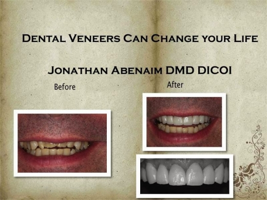 Jonathan Dental Spa Dental Implant Center Jonathan Abenaim DMD in Hawthorne City, New Jersey, United States - #3 Photo of Point of interest, Establishment, Health, Dentist