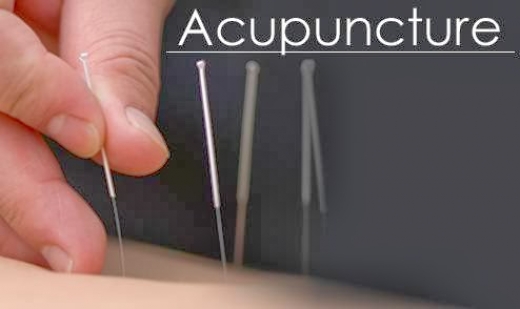 Two Tiger Acupuncture in Kings County City, New York, United States - #4 Photo of Point of interest, Establishment, Health