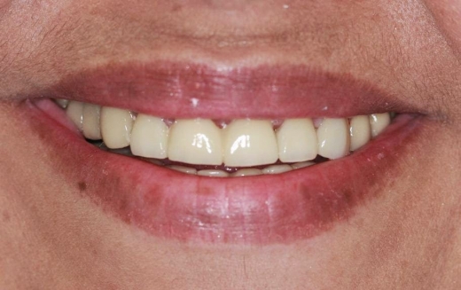Cosmetic Dentistry: Dr. Valentin and Alexander Lezhansky DDS in Brooklyn City, New York, United States - #2 Photo of Point of interest, Establishment, Health, Dentist