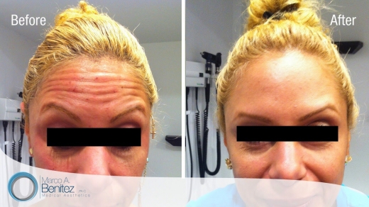 Photo by <br />
<b>Notice</b>:  Undefined index: user in <b>/home/www/activeuser/data/www/vaplace.com/core/views/default/photos.php</b> on line <b>128</b><br />
. Picture for Premier Aesthetics- Astoria Botox Dermal Filler Plasma PRP in Queens City, New York, United States - Point of interest, Establishment, Health, Spa