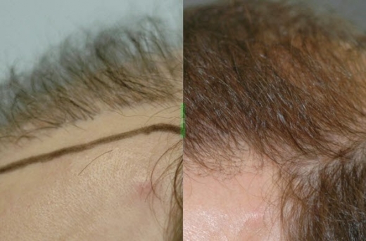 Dr. Robin H. Unger, MD in New York City, New York, United States - #4 Photo of Point of interest, Establishment, Health, Hair care