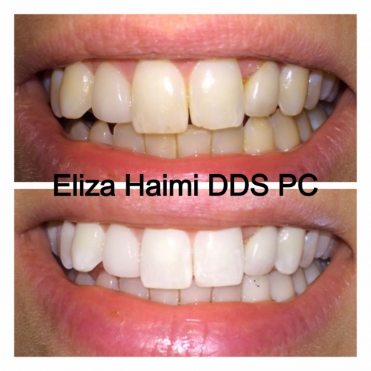 Eliza Haimi DDS in Great Neck City, New York, United States - #3 Photo of Point of interest, Establishment, Health, Dentist