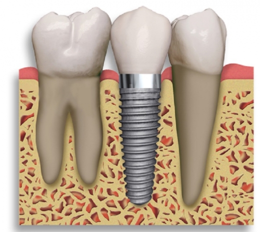 Michelle Trachtenberg, DDS in New York City, New York, United States - #2 Photo of Point of interest, Establishment, Health, Dentist