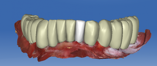 Digital Dental Designs in Bronx City, New York, United States - #4 Photo of Point of interest, Establishment, Health