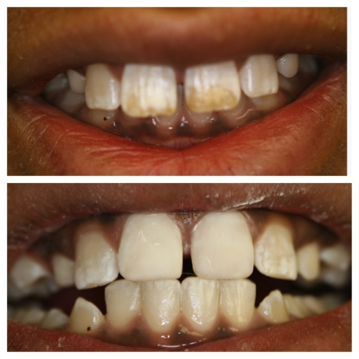 Photo by NYC Cosmetic and General Dentistry for NYC Cosmetic and General Dentistry
