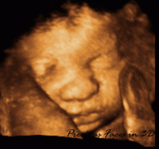 Photo by PRECIOUS FACES IN 3D ULTRASOUND - MOBILE for PRECIOUS FACES IN 3D ULTRASOUND - MOBILE