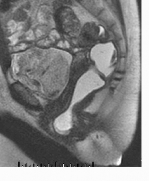 NYMI New York Medical Imaging Associates in New York City, New York, United States - #3 Photo of Point of interest, Establishment, Health