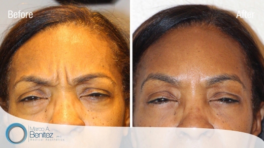 Photo by <br />
<b>Notice</b>:  Undefined index: user in <b>/home/www/activeuser/data/www/vaplace.com/core/views/default/photos.php</b> on line <b>128</b><br />
. Picture for Premier Aesthetics- Astoria Botox Dermal Filler Plasma PRP in Queens City, New York, United States - Point of interest, Establishment, Health, Spa