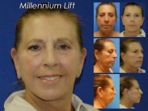 New York Face Lift Surgeon in New York City, New York, United States - #2 Photo of Point of interest, Establishment, Health, General contractor, Doctor