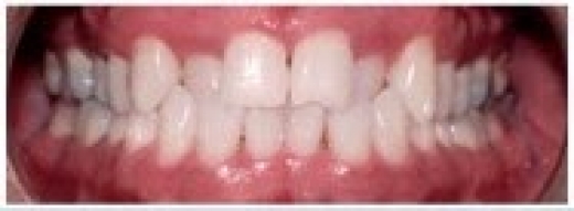 Dr. Vincent Mastronardi in West Orange City, New Jersey, United States - #2 Photo of Point of interest, Establishment, Health, Dentist