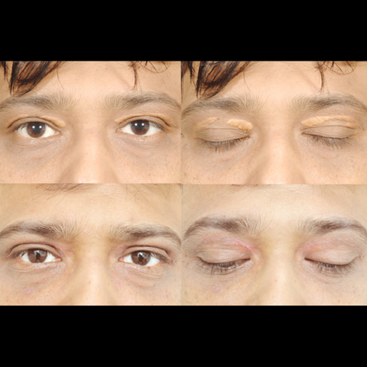 Xanthelasma NYC in New York City, New York, United States - #3 Photo of Point of interest, Establishment, Health, Doctor