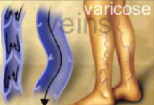 Photo by <br />
<b>Notice</b>:  Undefined index: user in <b>/home/www/activeuser/data/www/vaplace.com/core/views/default/photos.php</b> on line <b>128</b><br />
. Picture for Advanced Cosmetic Vein Center: Watson Marc C MD in Cedar Grove City, New Jersey, United States - Food, Point of interest, Establishment, Store, Health, Doctor