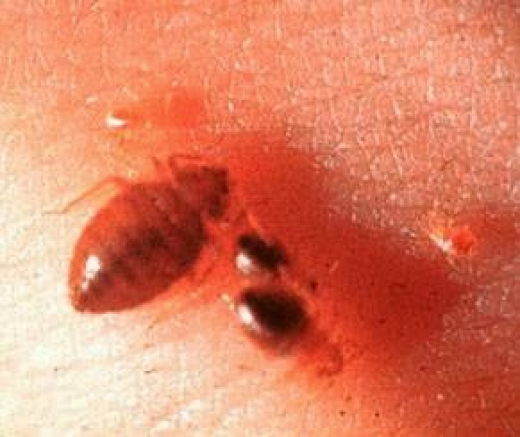 Photo by <br />
<b>Notice</b>:  Undefined index: user in <b>/home/www/activeuser/data/www/vaplace.com/core/views/default/photos.php</b> on line <b>128</b><br />
. Picture for Bed Bug in New York City in New York City, New York, United States - Point of interest, Establishment, Store, Home goods store
